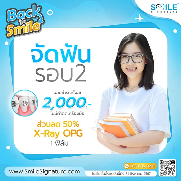 promotion metal braces 2nd round